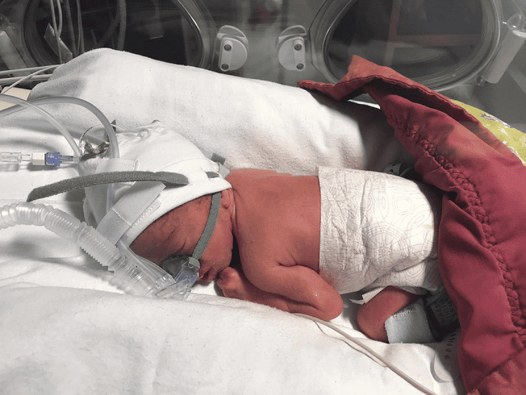 Leicester Hospitals Charity’s Christmas Appeal 2022 is rallying the community to raise vital funds to save the lives of babies born early or who have become unwell after birth. It only takes £6000 to purchase a Continuous Positive Airway Pressure (CPAP) machine that will provide lifesaving breathing support for babies in the Neonatal Intensive Care Unit at Leicester Hospitals.